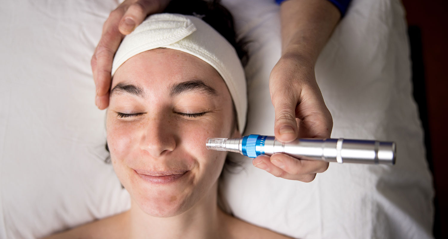 Person receiving microneedling